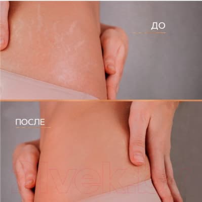Крем от растяжек Zeitun Питательный 10