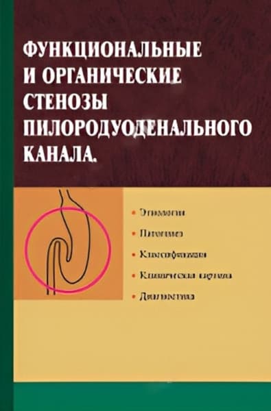 Учебное пособие Вышэйшая школа Функциональные и органичес. стенозы пилородуодненального канала